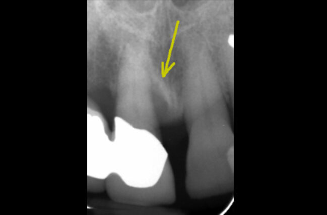 Before - Periodental