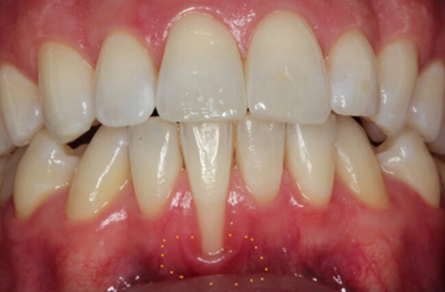 Before - Periodental